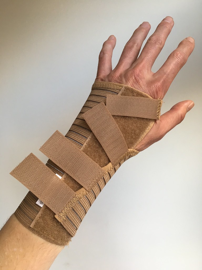 Sprained wrist I sprained my wrist at the gym. I've never … Flickr