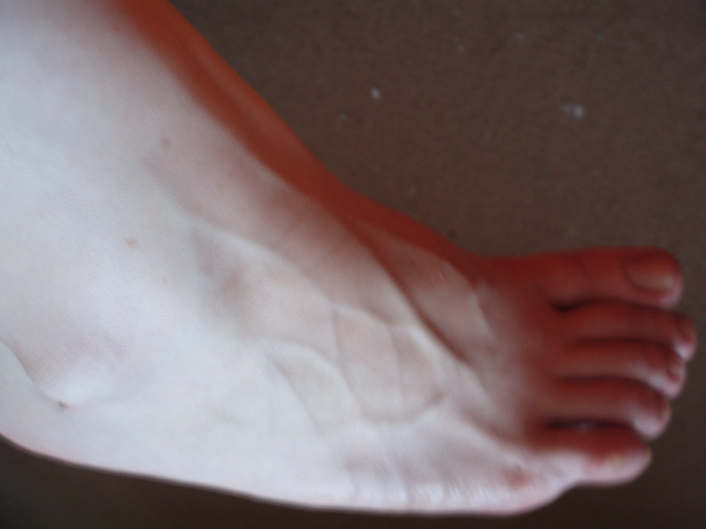 veiny feet veiny feet egon37 Flickr