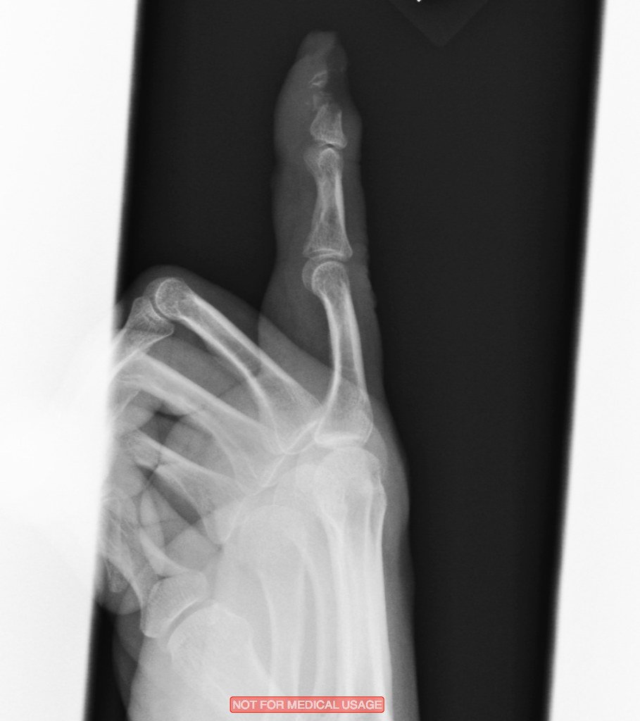 Shop Accident JointerX RayLeft index 1 sweejak Flickr