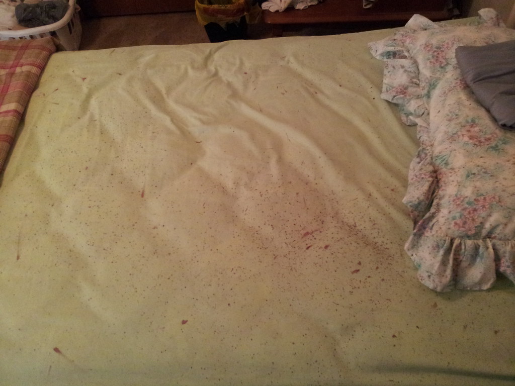 Waking Up With Bites May Be a Sign of Bed Bugs! Bed bugs c… Flickr