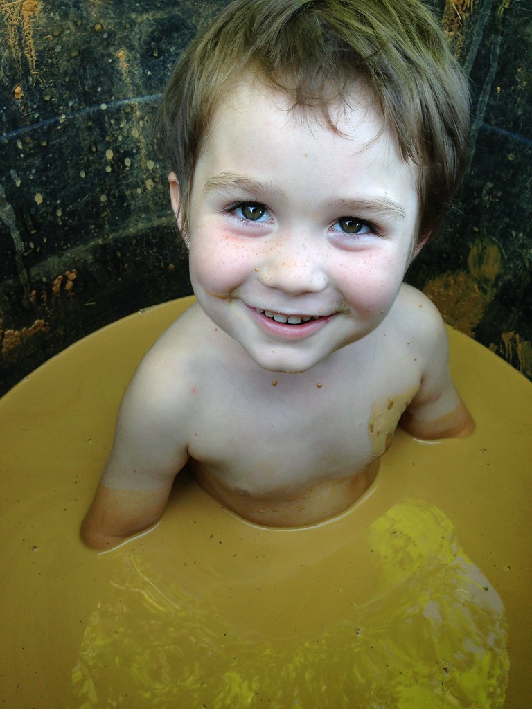 mud bath chicken pox treatment DNA Flickr