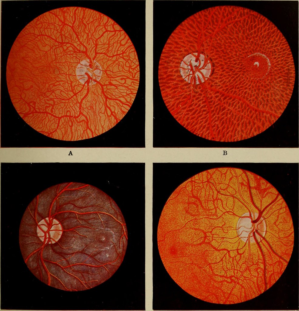 Image from page 132 of "Textbook of ophthalmology" (1919)… Flickr