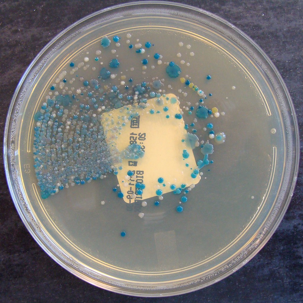 Flickriver Nathan Reading's photos tagged with urinemicrobiology