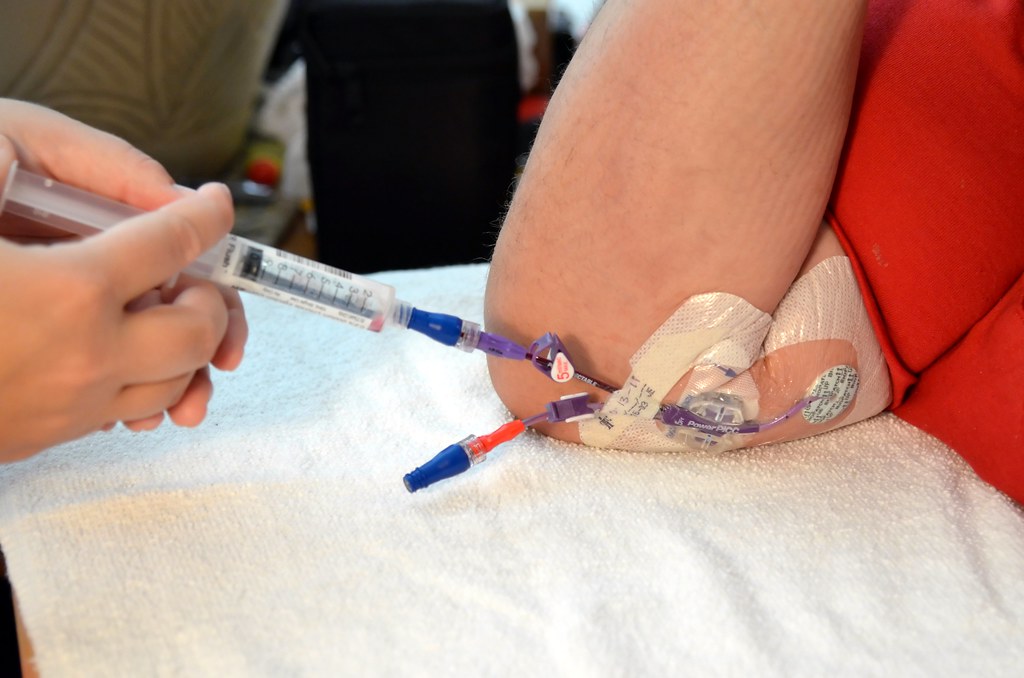 Home PICC IV 3 Check Flow Gently pull back slightly