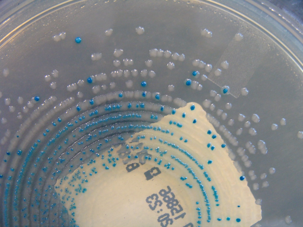 Mixed Culture 3 Detail Urine cultures on ChromID CPS mix… Flickr