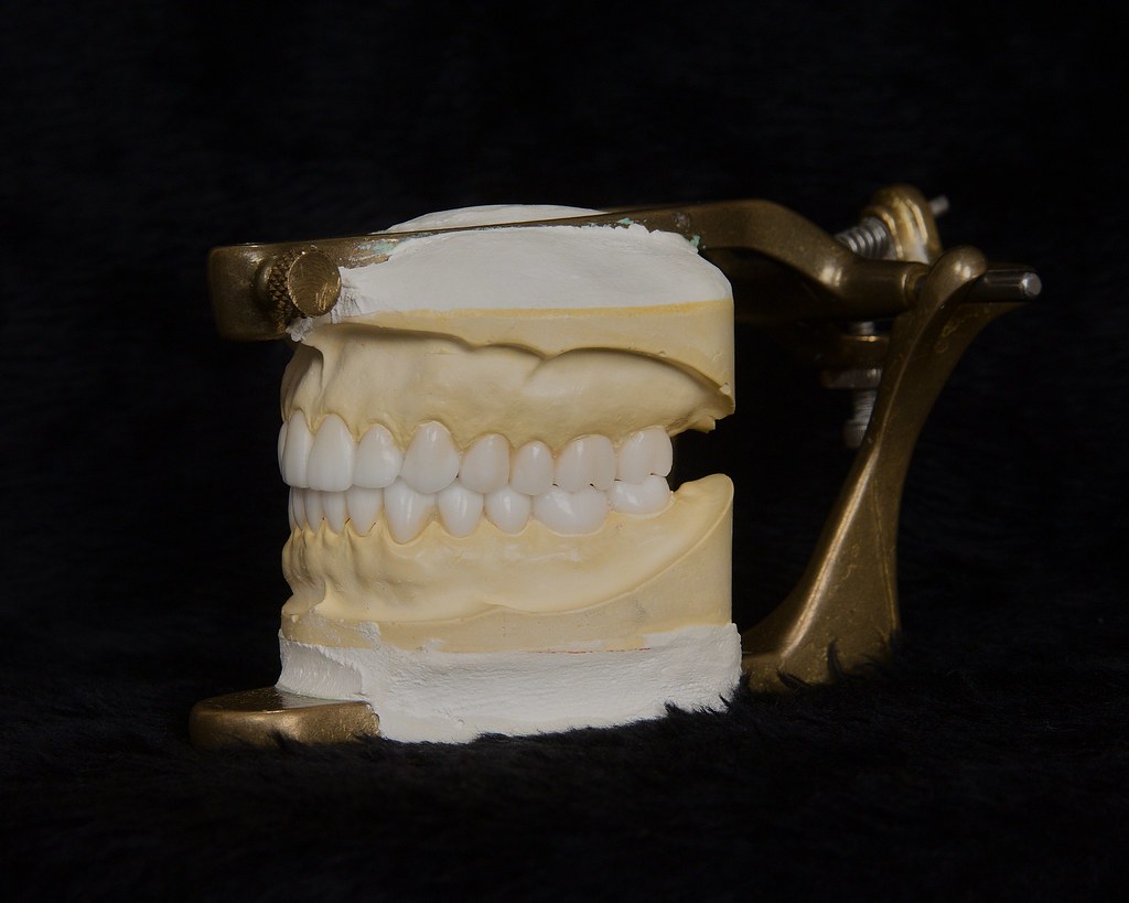 diagnostic wax up9 dental technician tech diagnostic wax u… Flickr