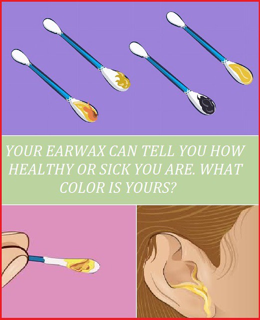 EARWAX1 Your Earwax Can Tell You How Healthy Or Sick You A… Flickr