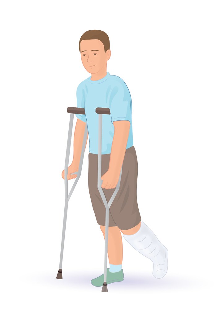 Broken Leg Instructions for correct sourcing Please sourc… Flickr