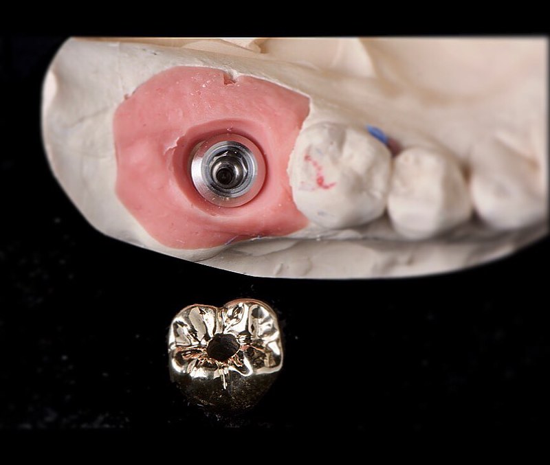 Full Cast Studio32 Dental Laboratory