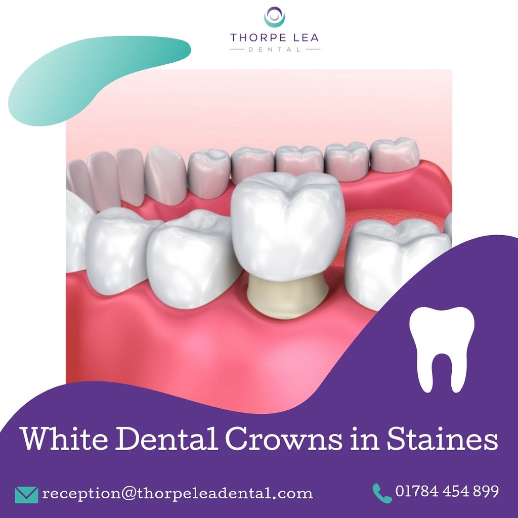 White Dental Crowns Staines Crowns are a fantastic option … Flickr