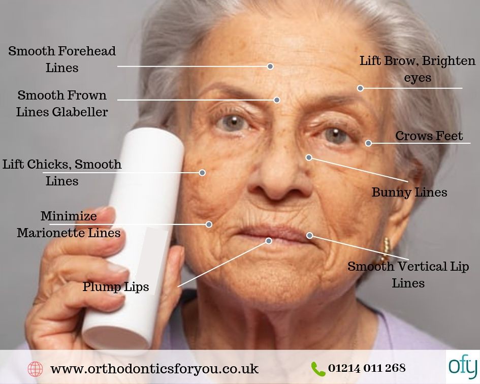 Dermal Fillers In Solihull Orthodontics For You offers Der… Flickr