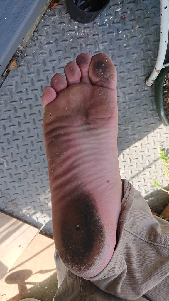 Dirty feet Barefoot rough calloused cracked heels dirtysole88 Flickr