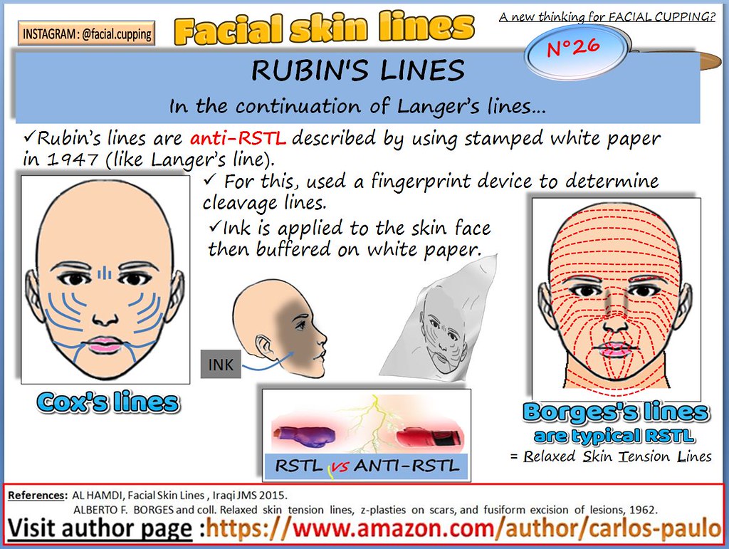 Facial skin lines n°26 Rubin's lines FACIAL SKIN LINES N°… Flickr