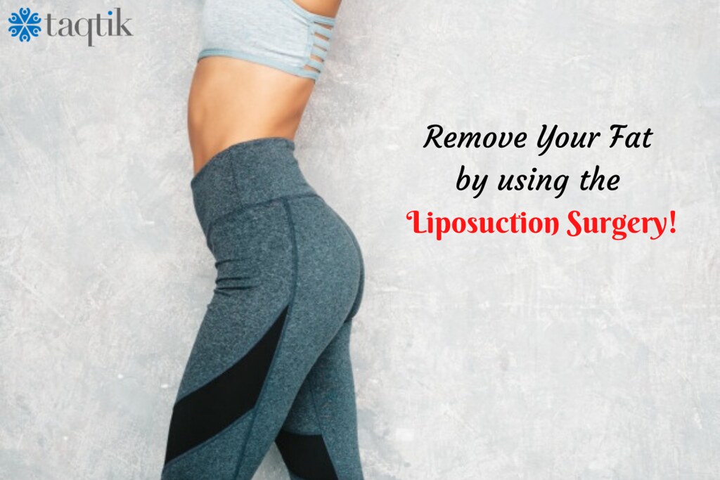 Liposuction Treatment Liposuction surgery is a cosmetic su… Flickr
