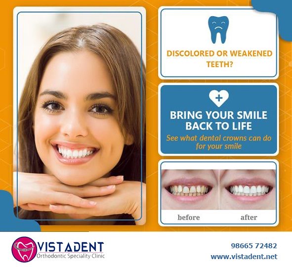 Braces specialists near me At the Vistadent clinic, we pro… Flickr