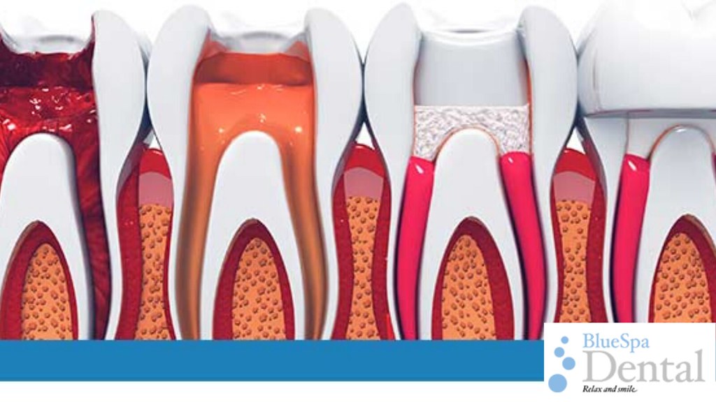 Best Root Canal Specialist Near Me Searching for some amaz… Flickr