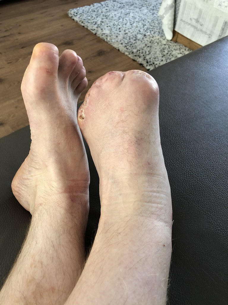 Flickriver Most interesting photos tagged with toeless