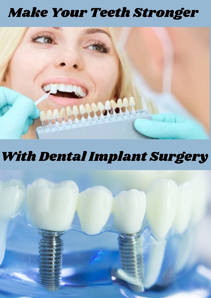Dental Implant Surgery When you want to fix your broken to… Flickr