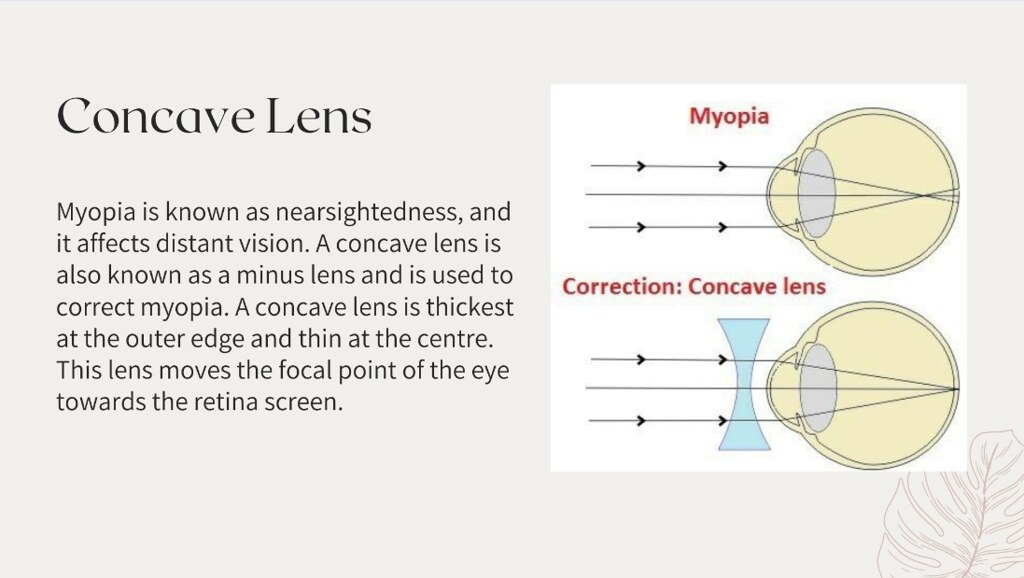 How Do Prescriptions Glasses Work? Flickr