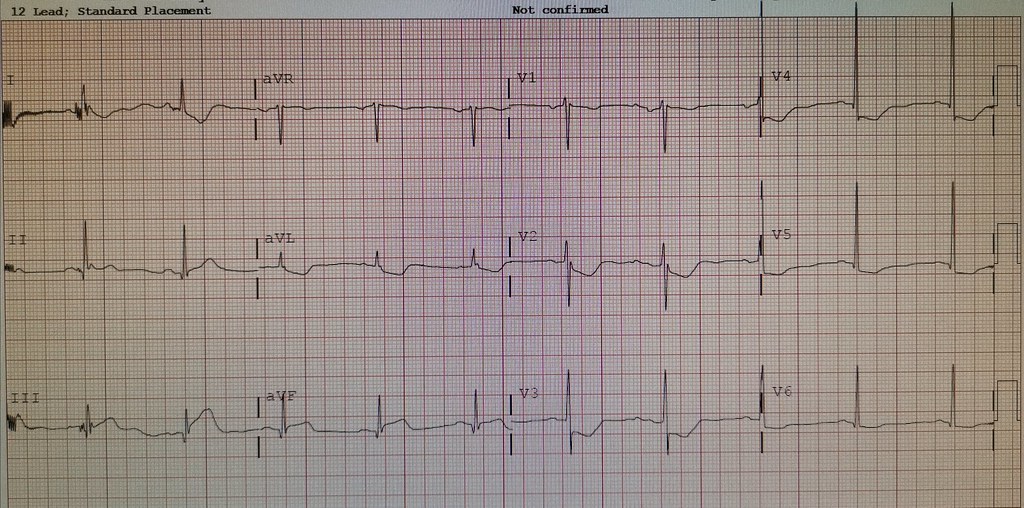 20200913_053458 Intermittent Chest pain x 1 week. On a… Flickr