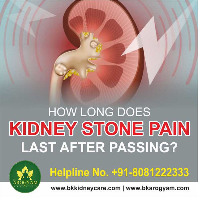 How long does kidney stone pain last after passing Flickr