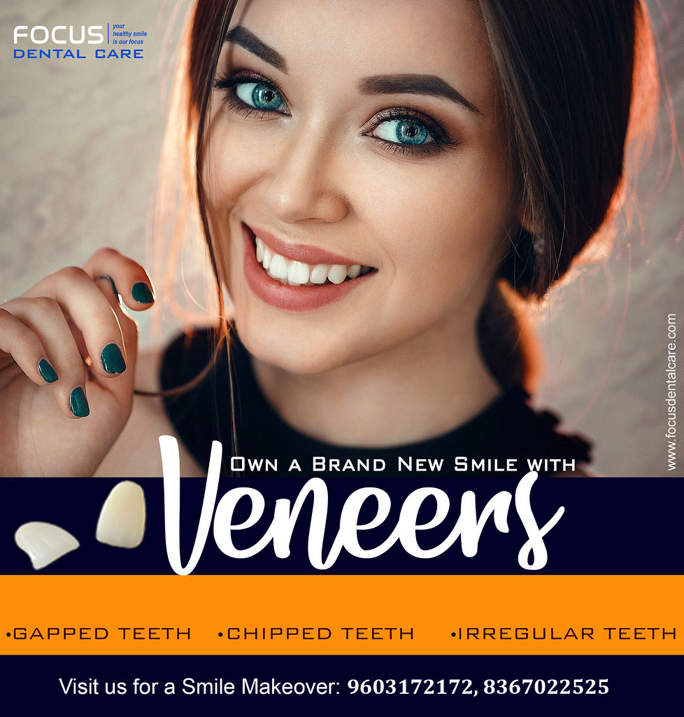 Dental Veneers in Hyderabad Own A Brand New Smile With Den… Flickr
