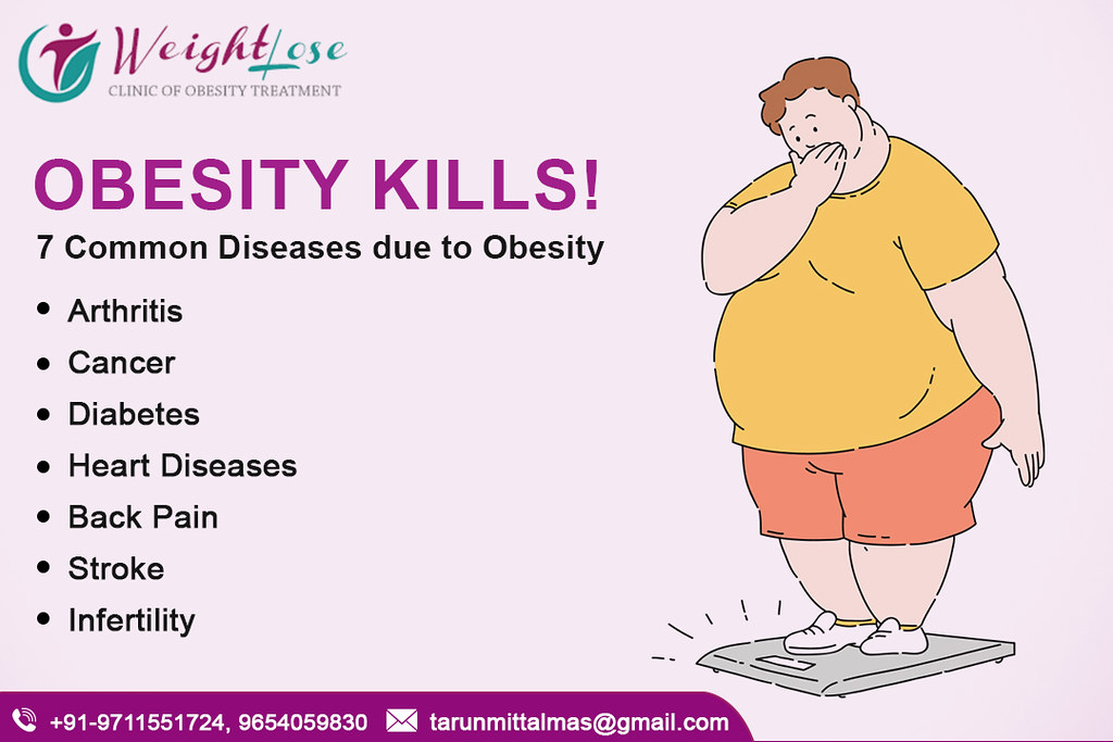 Best Bariatric Surgery Center in Delhi Surgery is a seriou… Flickr