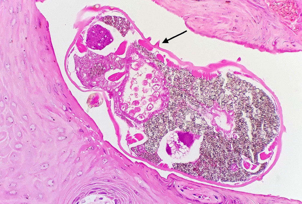 Scabies Rash vs Eczema Skin Conditions Decoded Healthy Habitat
