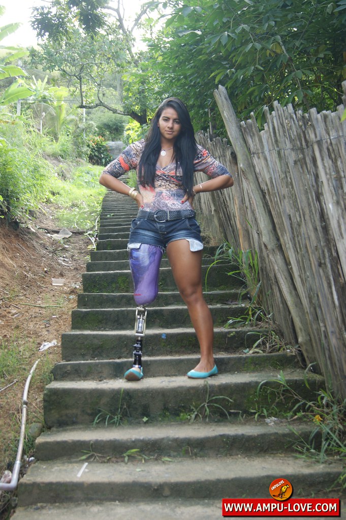 Amputee Camila RAK | right above the knee amputee Camila fro… | Ampu
