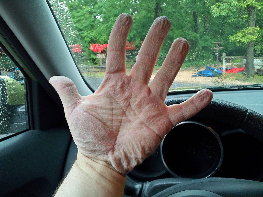 Wrinkled hands following tubing adventure Wrinkled hands f… Flickr