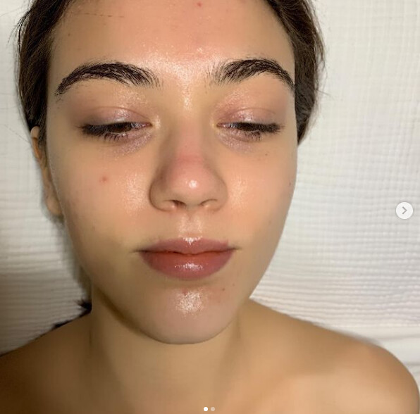 Deep Cleaning Facial at Buttercup Skin Care Clean face aft… Flickr