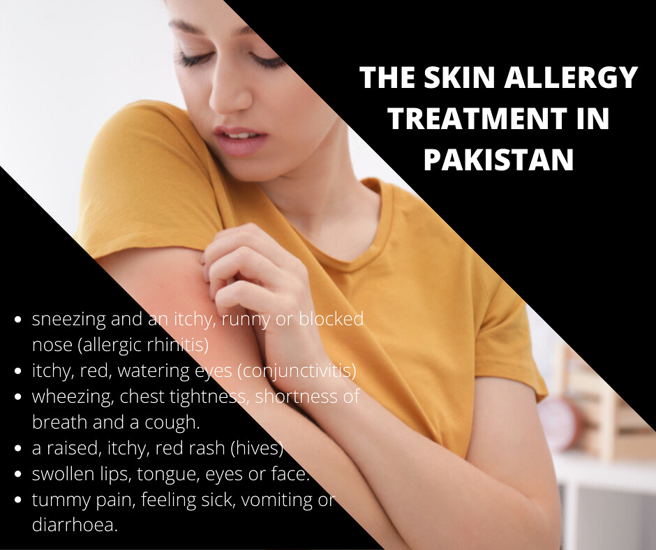 THE SKIN ALLERGY TREATMENT IN PAKISTAN Khujli jild ki bema… Flickr