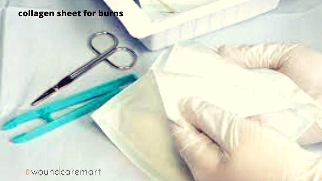 collagen sheet for burns Wound care can prevent more serio… Flickr