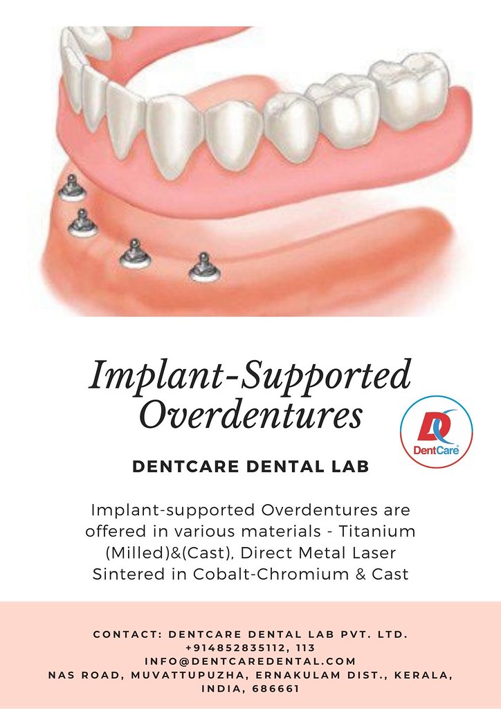 ImplantSupported Overdentures DentCare Dental Lab Flickr