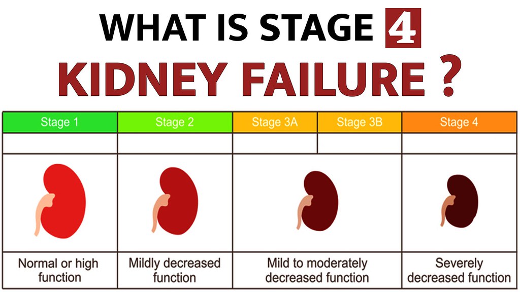 What is Stage 4 Kidney Failure Chronic kidney disease has … Flickr