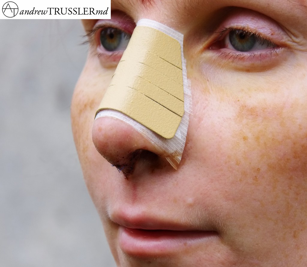 best plastic surgeon austin, plastic surgeon in austin tx,… Flickr