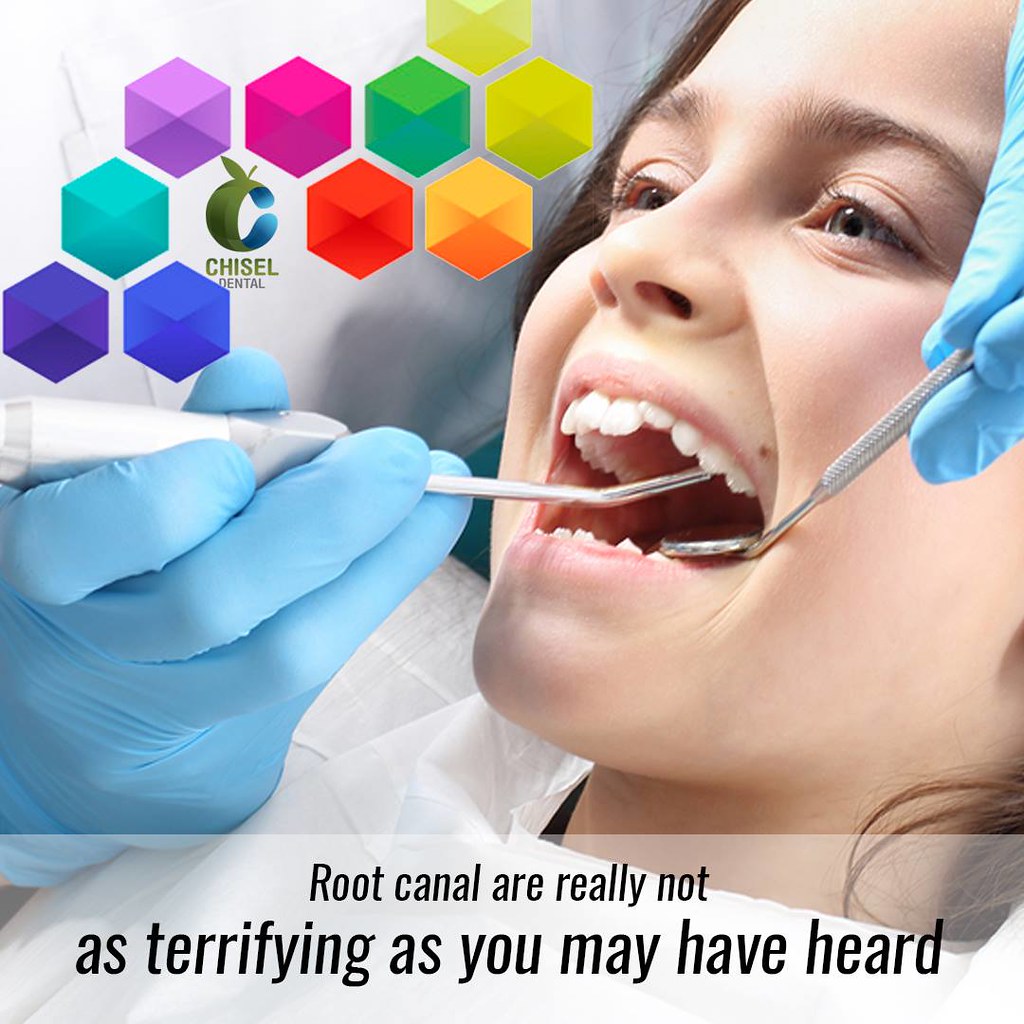 root canal treatment Bangalore Chisel Dental Root canal a… Flickr