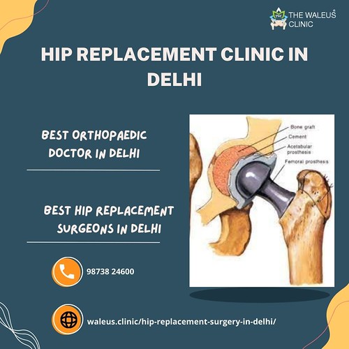 Hip replacement clinic in Delhi Dr. Pankaj Walecha is the … Flickr