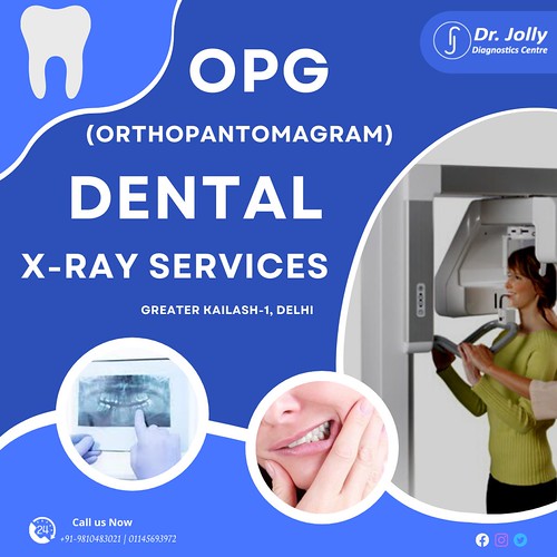 OPG Orthopantomogram Dental X Ray Cost in Greater Kailash … Flickr