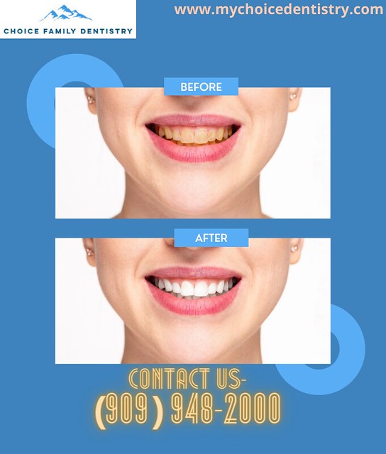 Choice Family Dentistry of Rancho Cucamonga visit our offi… Flickr