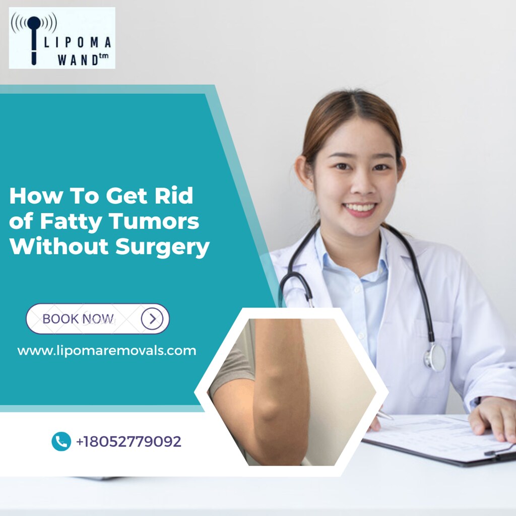 How To Get Rid of Fatty Tumors Without Surgery Lipoma Wa… Flickr