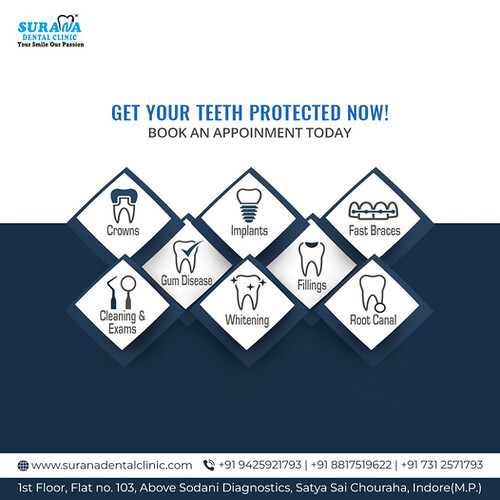 Oral & Teeth Cleaning in Indore Surana Dental Clinic Flickr