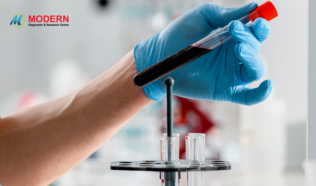 Blood Home Collection For Blood Test in Kolkata MDRCIndia … Flickr