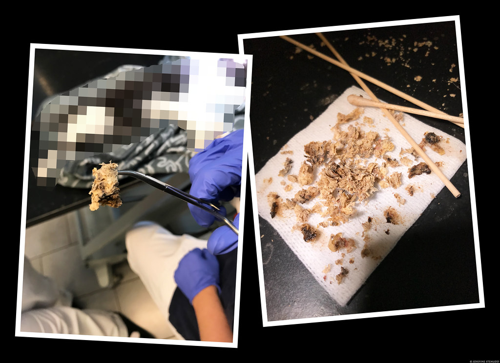 Very flaky lump o' ear wax dug out of a sedated cat (not b… Flickr