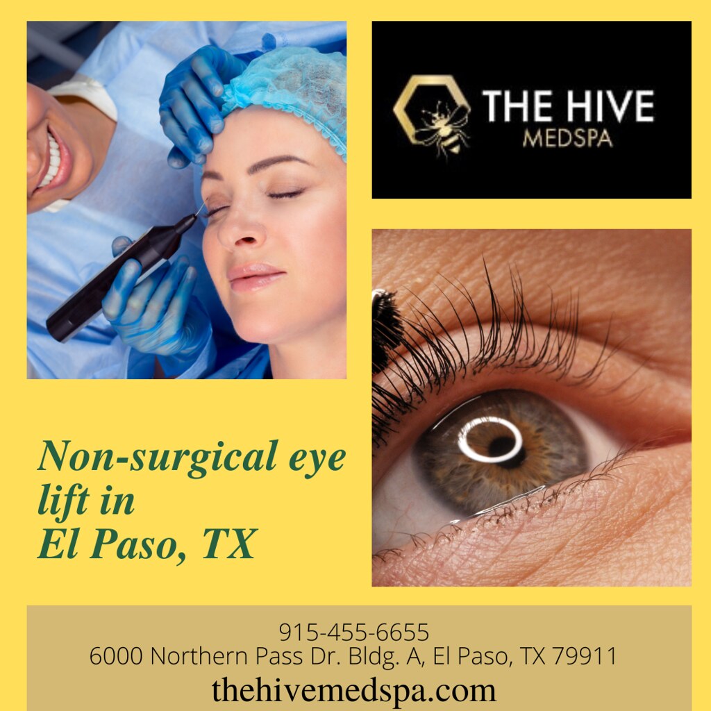 Nonsurgical eye lift in El Paso, TX Botox Cosmetics in El… Flickr