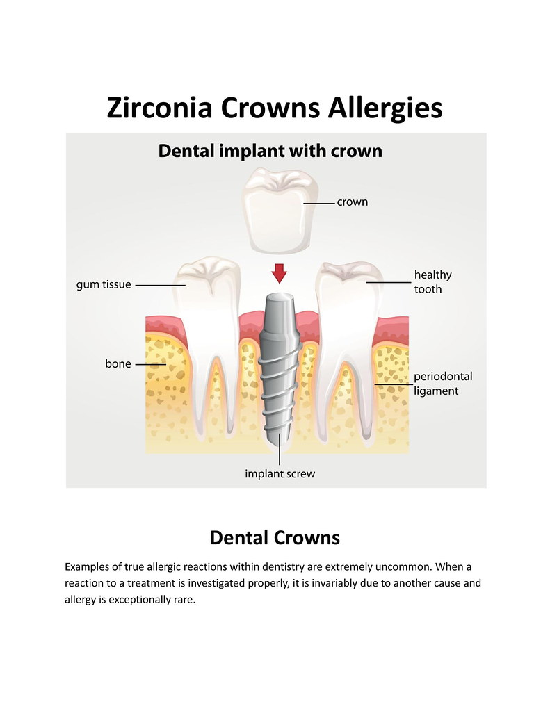 Zirconia Crowns Allergies Examples of true allergic reacti… Flickr