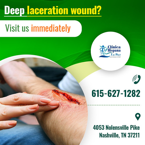 Top ways to manage Deep Laceration Wound You cannot treat … Flickr