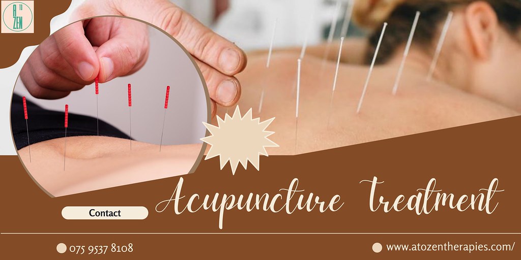 Get The Best Acupuncture Treatment In London Facial acupun… Flickr