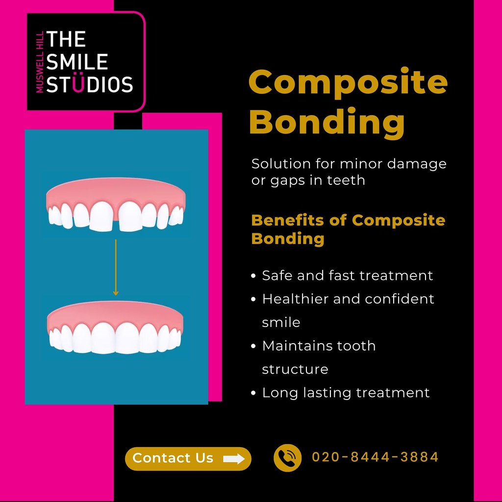 Composite Bonding in Muswell Hill Composite bonding makes … Flickr