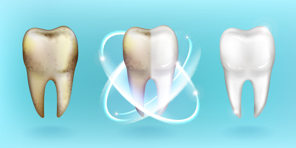 Sinsational Smiles Teeth Whitening Apple A Day Dental Flickr